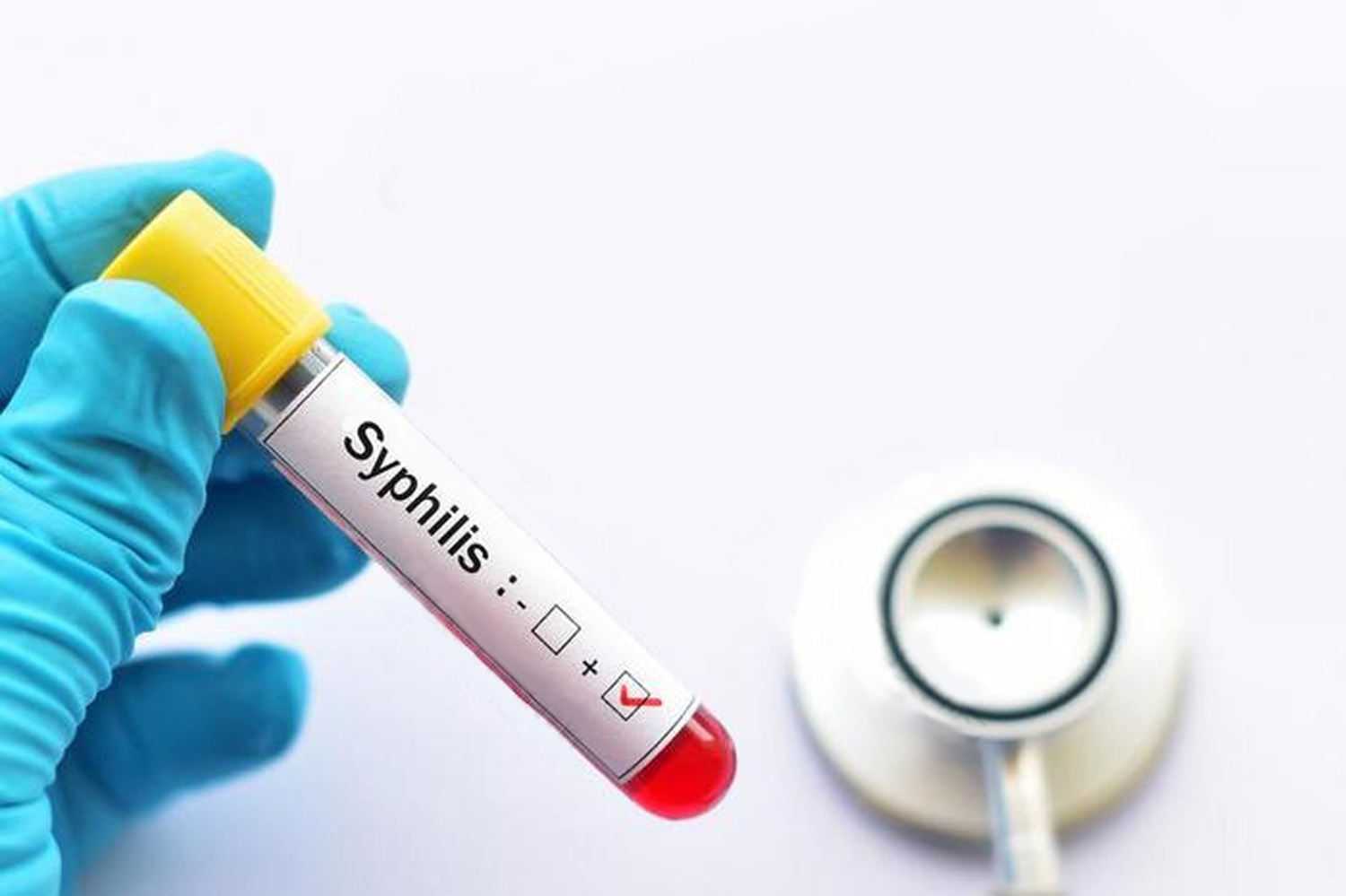 包圖網(wǎng)89557454梅毒積極的-小樣.jpg 包圖網(wǎng)89557454梅毒積極的-小樣.jpg